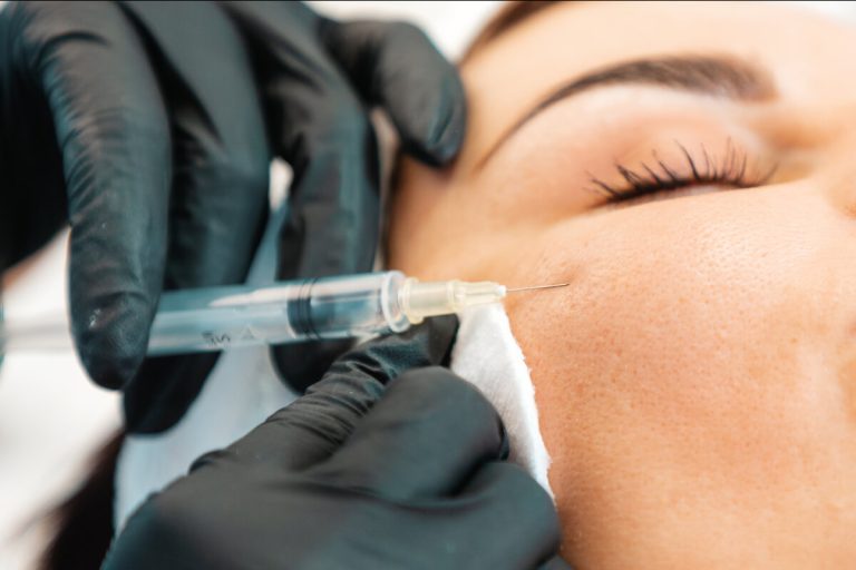 Cheek Filler in Algonquin at Fox River MedSpa in Algonquin, Illinois