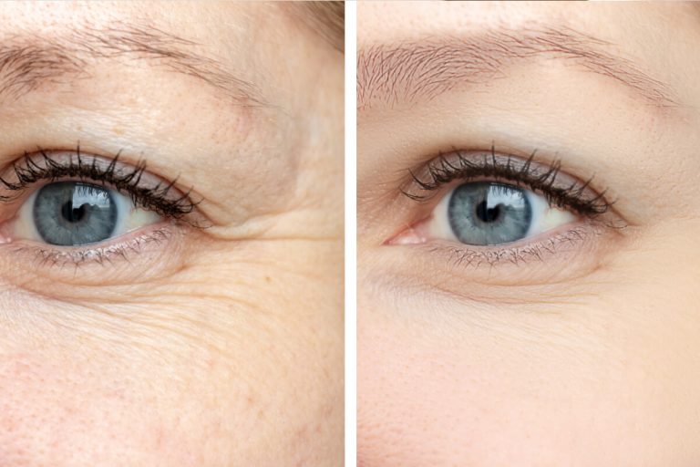 Medical Esthetics in Algonquin at Fox River MedSpa in Algonquin, Illinois