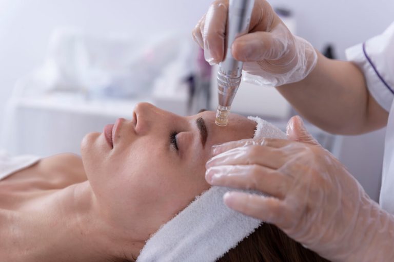 ProCell Microchanneling in Algonquin at Fox River MedSpa in Algonquin, Illinois